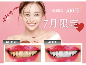 エクシアホワイトニング 草津店