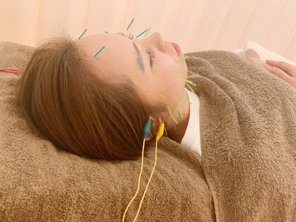 まつもと 庄内鍼灸整骨院の写真