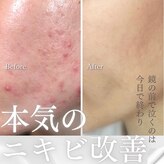 小顔コルギサロン シー(She)