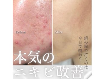 小顔コルギサロン シー(She)