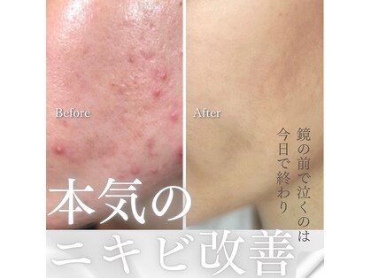 小顔コルギサロン シー(She)の写真