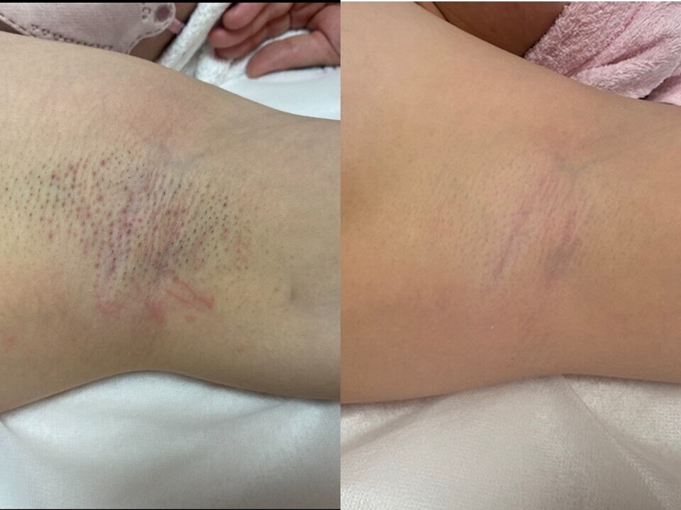 エステティック 華｜ホットペッパービューティー