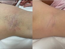 エステティック 華