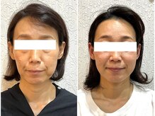 ウェリナ平和堂長久手院/小顔矯正/骨盤矯正/美脚サロン