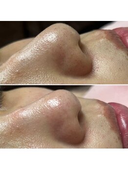 パッチ バイ サロンデヤンス(Patch by SALON DE YANSU)/