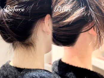 ピミル(PIMIL)/うなじ脱毛