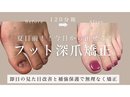 ヴェールリム(verl lim)の写真
