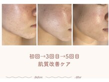 エステティックサロン シーズ/戻りながらも前に進む