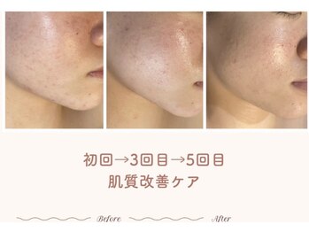 エステティックサロン シーズ/戻りながらも前に進む