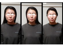 美容整体ナチュラル(natural)の雰囲気(ダイエットなしでこの効果!)