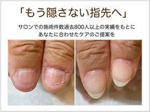 つめびより トラブルネイル研究所 柏 by doue
