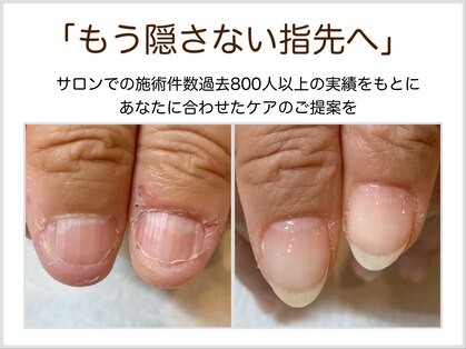 つめびより トラブルネイル研究所 柏 by doueの写真
