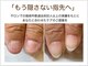つめびより トラブルネイル研究所 柏 by doueの写真