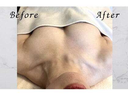 ボニービューティー(Bony Beauty)の写真