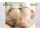 ボニービューティー(Bony Beauty)の写真