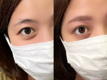 チルアンドアイ 千葉駅前店(Chill&Eye)/美眉スタイリング/BeforeAfter