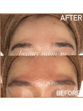 エム(M)/赤みもなくなる◎敏感肌の方