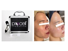 レイ(Rey)/最新肌質改善プロセルセラピーズ