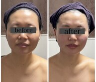 小顔アンドエイジングケア専門店 ビゼ(美sser)