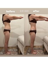 &still【アンドスティル】【4/1 NEW OPEN（予定）】 /【痩身リンパ】全身