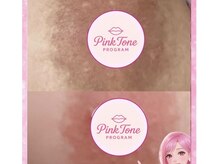 ビューティーツリー(Beauty Tree)/背中・二の腕スッキリ