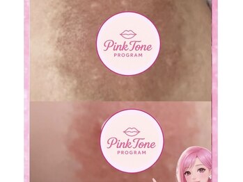 ビューティーツリー(Beauty Tree)/背中・二の腕スッキリ