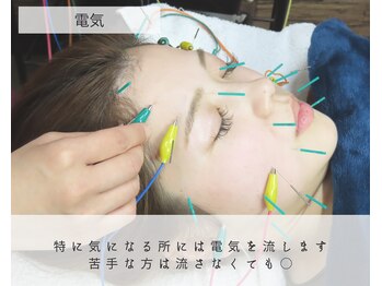 わきさか鍼灸整骨院・鍼灸院 レーヴ(Reve)/