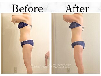 リルチェ 自由が丘(RILUCE)/40代　女性