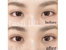 ラン(RAN)/ラッシュリフト