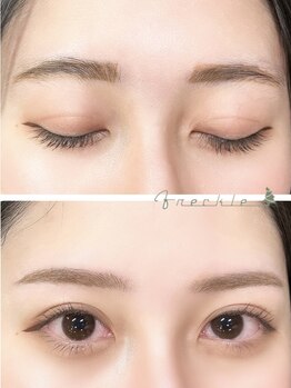 フレックル(freckle)/トレンド平行美眉