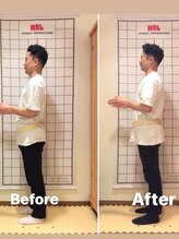 クラレ整体院 中野/結婚式に向けて姿勢改善！