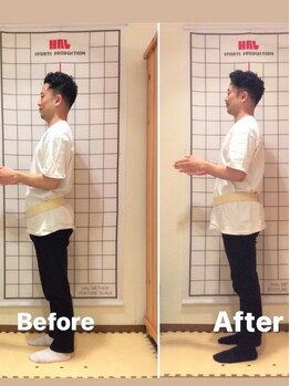 クラレ整体院 中野/結婚式に向けて姿勢改善！