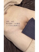 ホッコリ 府中店(HOKKORI)/【男女OK！】痛みの少ない脱毛