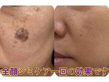 東洋経絡エステ アンド リラクゼーション