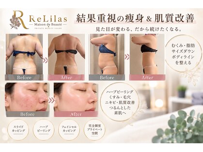 リリラ(ReLilas)の写真