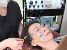 トイ鍼灸接骨院(TOY鍼灸接骨院)/●美容鍼