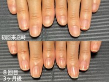 エムズ(m's)の雰囲気（見違えるほど美爪になり、自信のもてる指先に☆）