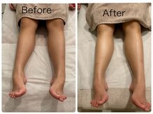 チル アンド リラックス(Chill and Relax)/足のくすみの解消に注目