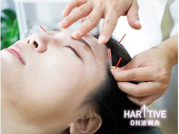 ハリティブ(HARITIVE)の写真/鍼デビューは女性専門の当院で*美容鍼/自律神経の乱れ/首肩こり/頭痛や眼精疲労は経験豊富な女性院長が解決