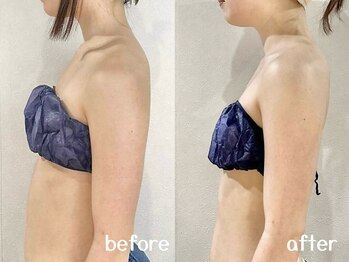 サロン ド ブラン アオヤマ(Salon de BLANC AOYAMA)/お腹太り/巻き肩改善コース