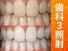 【会員／回数券】20分×3回歯科提携セルフホワイトニング