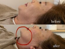 エネ ラッシュアンドブロウ バイ アンドエラ(ENNE Lash&Blow by&ERA)/小顔整体