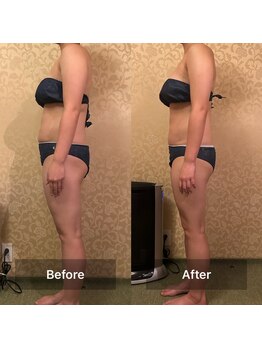 リンパケア顔筋美容のフフ(ff)/