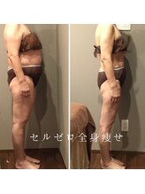 ムーン(MOON)/【春の薄着準備】