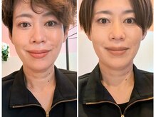 そら/二重あご・顎下のもたつきに特化