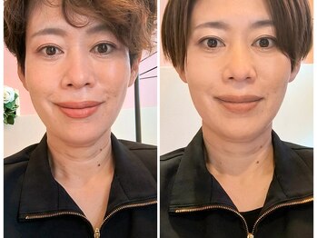 そら/二重あご・顎下のもたつきに特化