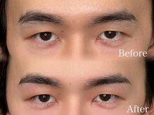 ノエ アイ(Noe.)/Brow wax
