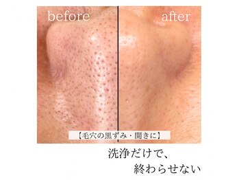 ル シーニュの写真/「毛穴を埋める」から「キメを育てる」へ。
肌構造に基づいた精密な洗浄で、内側から澄み渡る素肌。