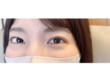 キウ(kiu.)/タレ目デザイン