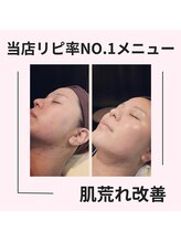 シン(Shin)/【綺麗なお肌に♪】